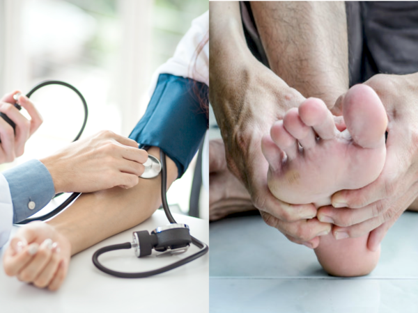 Huyết áp cao: Cẩn thận với những triệu chứng này ở bàn chân, khám nhanh kẻo rước họa vào người - Ảnh 2